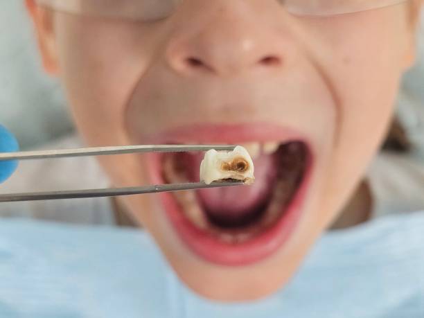 Best Knocked-Out Tooth Emergency  in Ketchikan, AK